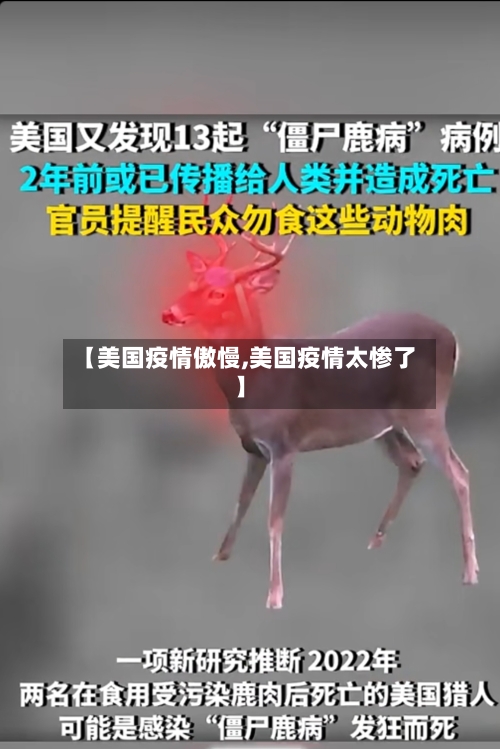 【美国疫情傲慢,美国疫情太惨了】-第2张图片